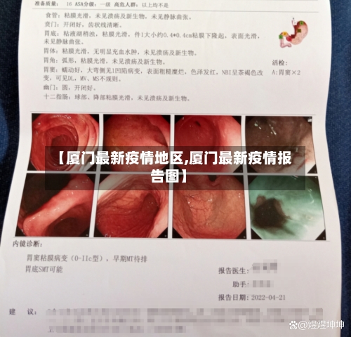 【厦门最新疫情地区,厦门最新疫情报告图】-第2张图片