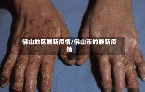 佛山地区最新疫情/佛山市的最新疫情-第3张图片